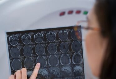 Alzheimer vs deterioro cognitivo vascular