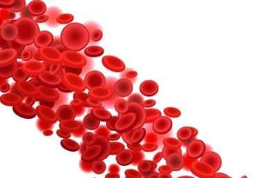 Cómo identificar y tratar la trombosis